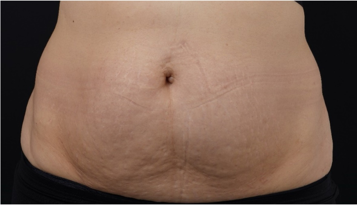panza antes2 panza antes2